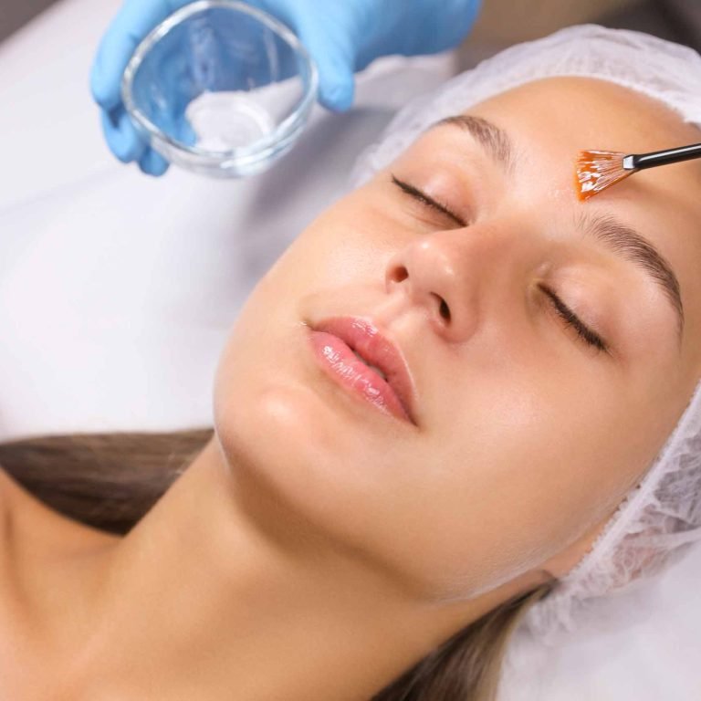 Que-es-un-peeling-quimico-facial
