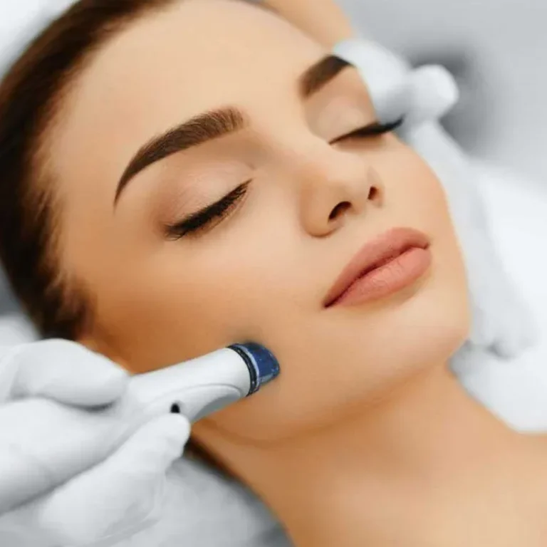 microdermoabrasion-1024x715