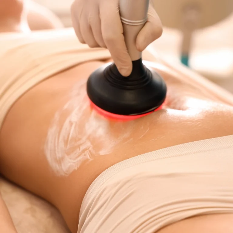 radiofrecuencia-corporal-1