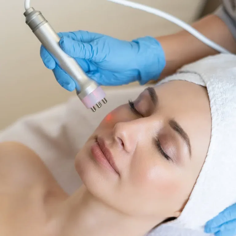 radiofrecuencia-facial